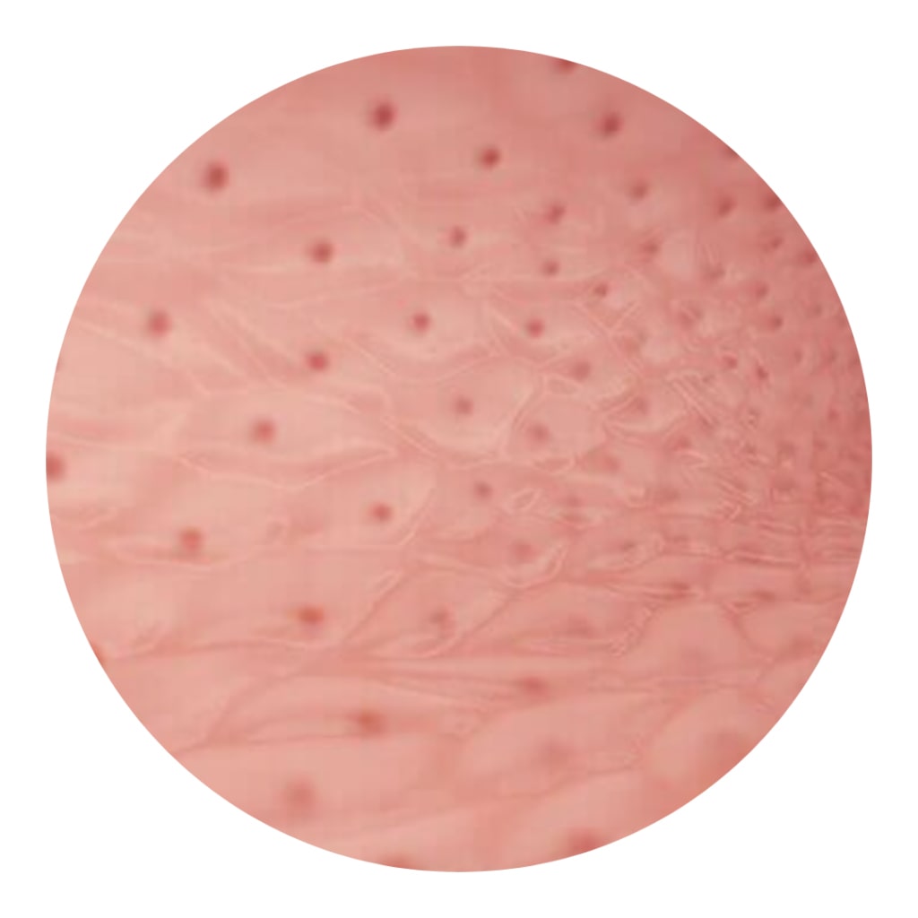 im2jpg-min dolor-lumbar-2021